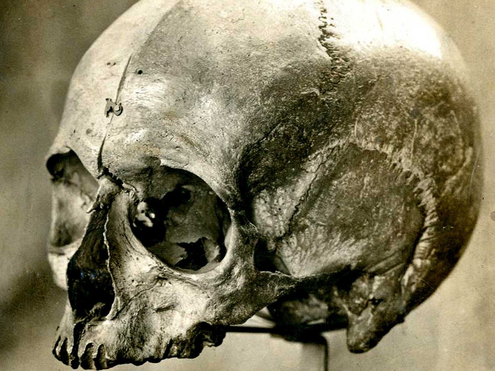 The skull of Eugene Aram is now on display in the Stories of Lynn museum in King's Lynn